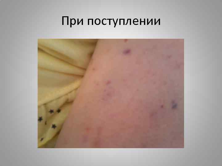 При поступлении 