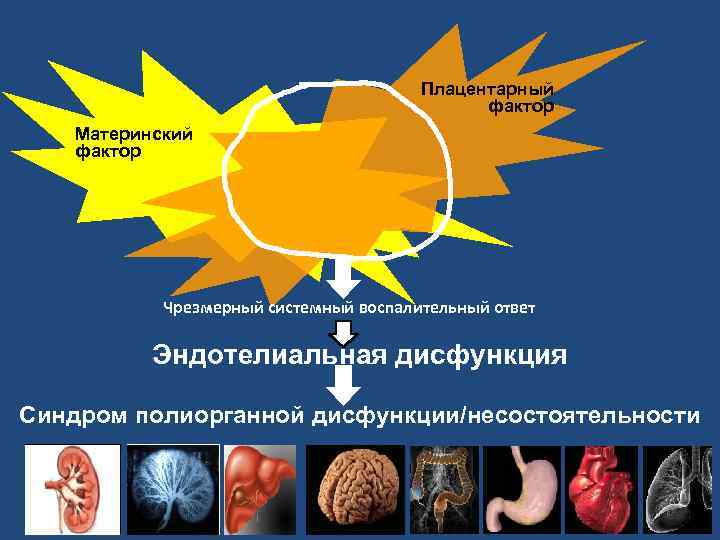 Плацентарный фактор Материнский фактор Чрезмерный системный воспалительный ответ Эндотелиальная дисфункция Синдром полиорганной дисфункции/несостоятельности 39