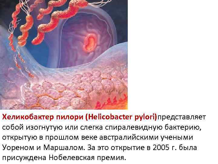 Хеликобактер пилори (Helicobacter pylori)представляет собой изогнутую или слегка спиралевидную бактерию, открытую в прошлом веке