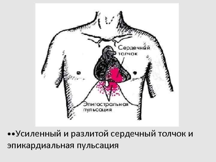 Сердечный толчок. Усиленный разлитой сеожечный толсле. Сердечный толчок усилен. Методика определения сердечного толчка.