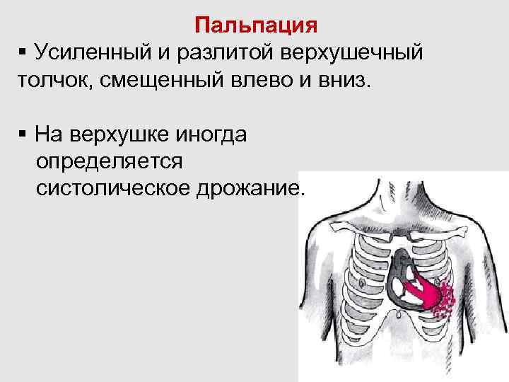 Верхушечный толчок. Гипертоническая болезнь верхушечный толчок. Верхушечный толчок при гипертонической болезни. Верхушечный толчок в норме расположен в 5-м межреберье. Усиленный разлитой верхушечный толчок.