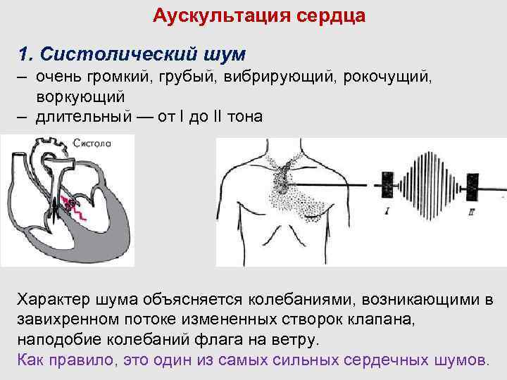 Шум на верхушке сердца свидетельствует о поражении