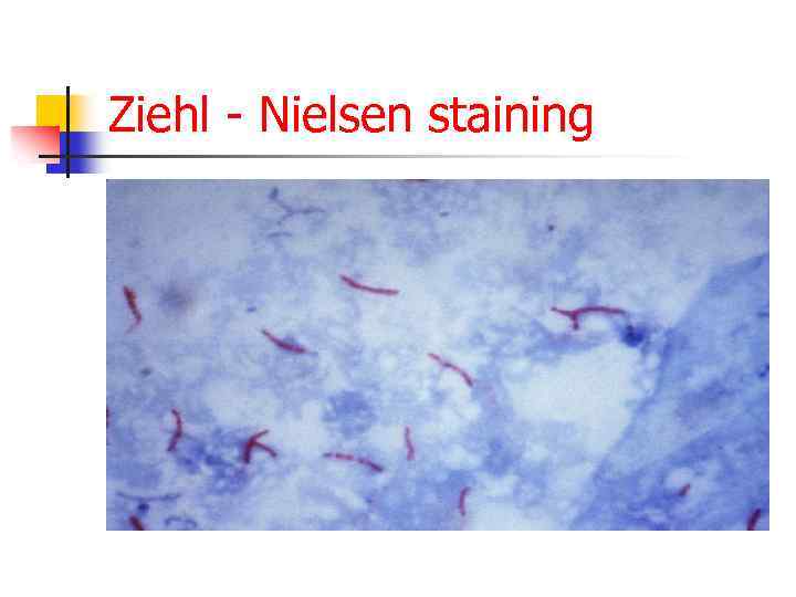 Ziehl - Nielsen staining 