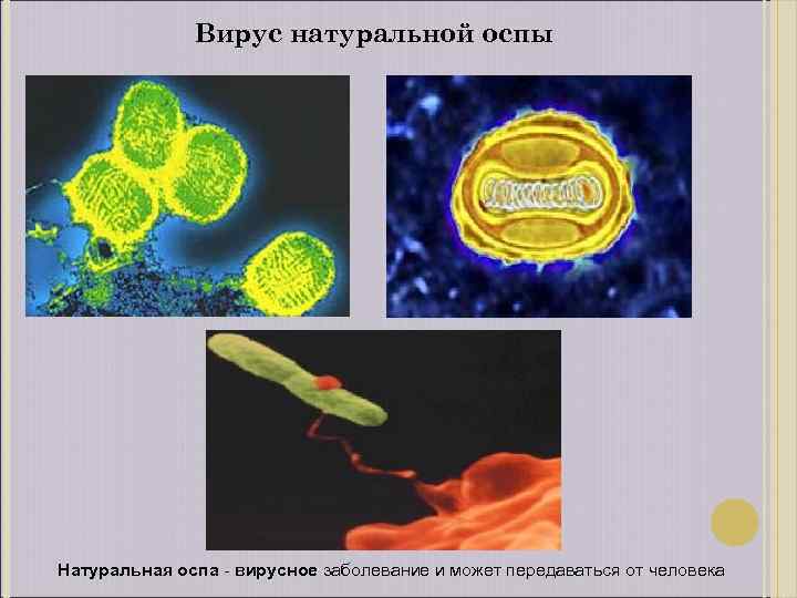 Вирус натуральной оспы Натуральная оспа - вирусное заболевание и может передаваться от человека 