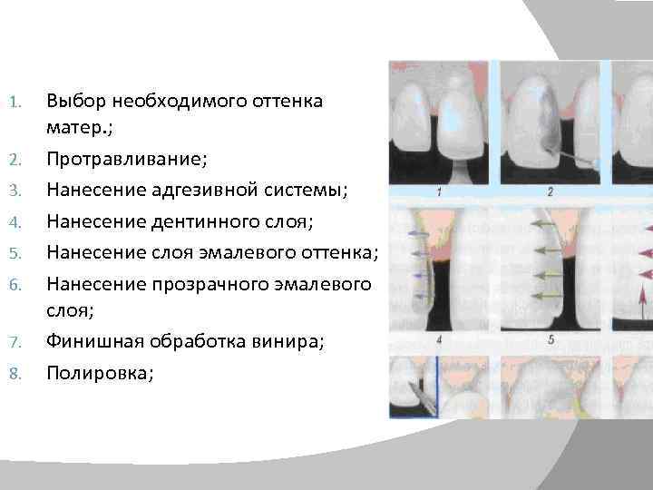 1. 2. 3. 4. 5. 6. 7. 8. Выбор необходимого оттенка матер. ; Протравливание;
