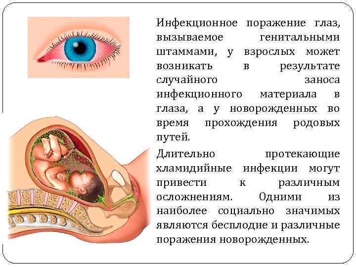 Инфекционное поражение глаз, вызываемое генитальными штаммами, у взрослых может возникать в результате случайного заноса