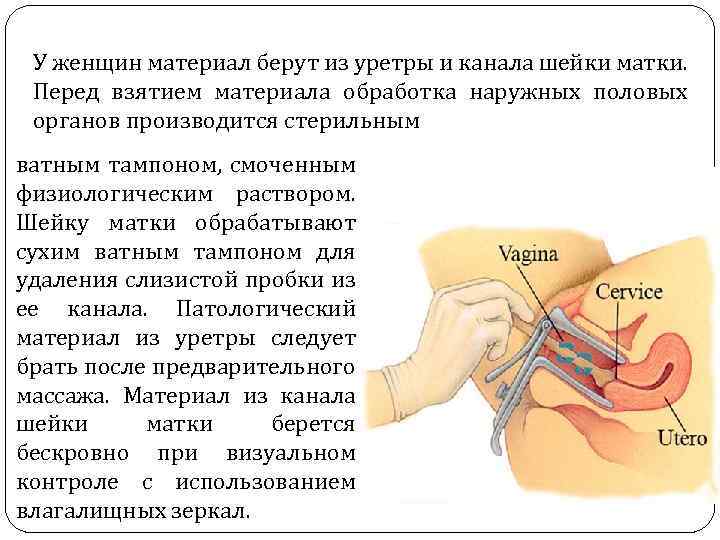 У женщин материал берут из уретры и канала шейки матки. Перед взятием материала обработка