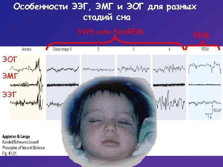 Особенности ЭЭГ, ЭМГ и ЭОГ для разных стадий сна SWS или Non. REM ЭОГ