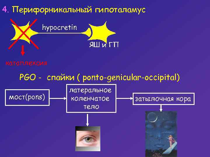 4. Перифорникальный гипоталамус hypocretin ЯШ и ГП катаплексия PGO - спайки ( ponto-genicular-occipital) мост(pons)