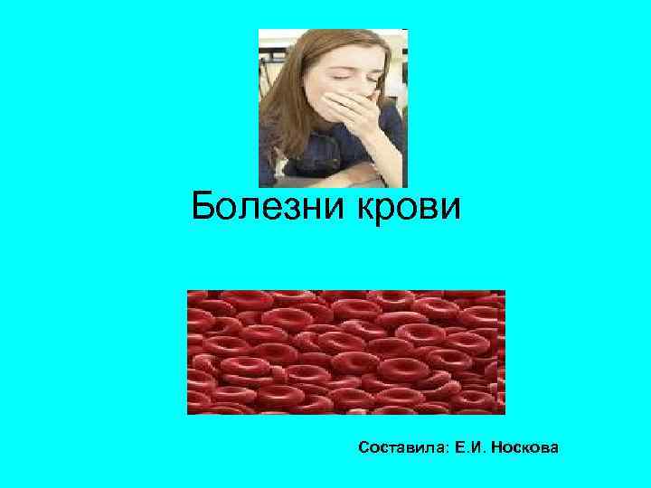 Болезни крови Составила: Е. И. Носкова 