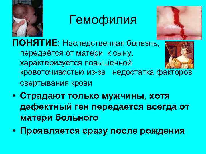 Гемофилия ПОНЯТИЕ: Наследственная болезнь, передаётся от матери к сыну, характеризуется повышенной кровоточивостью из-за недостатка