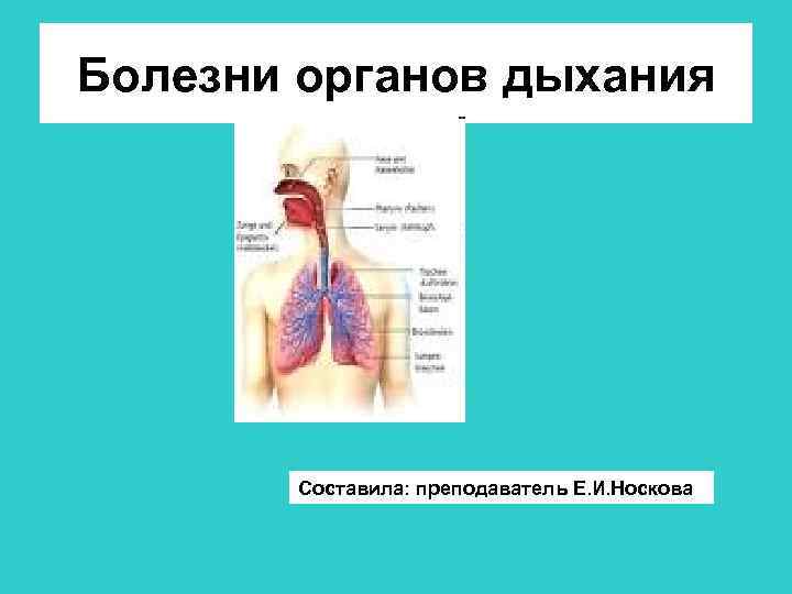 Болезни органов дыхания Составила: преподаватель Е. И. Носкова 