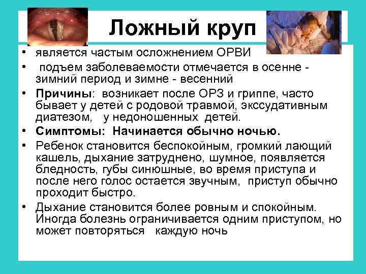 Ложный круп • является частым осложнением ОРВИ • подъем заболеваемости отмечается в осенне зимний