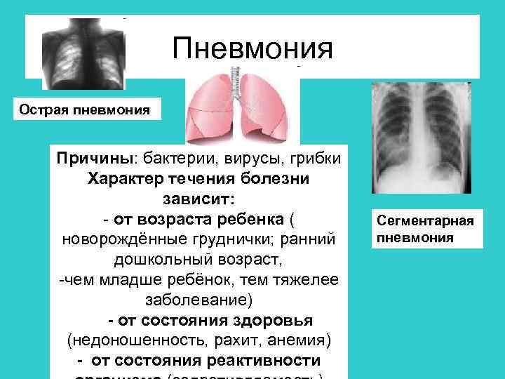 Пневмония Острая пневмония Причины: бактерии, вирусы, грибки Характер течения болезни зависит: - от возраста