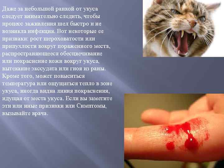Даже за небольшой ранкой от укуса следует внимательно следить, чтобы процесс заживления шел быстро
