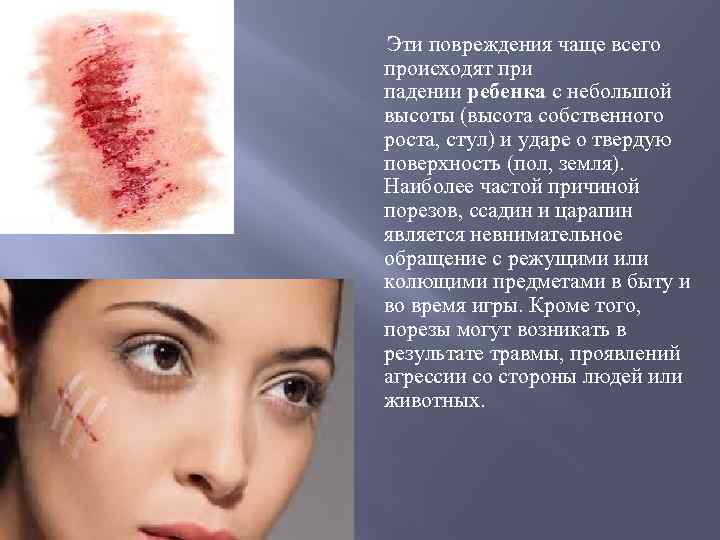 Эти повреждения чаще всего происходят при падении ребенка с небольшой высоты (высота собственного роста,