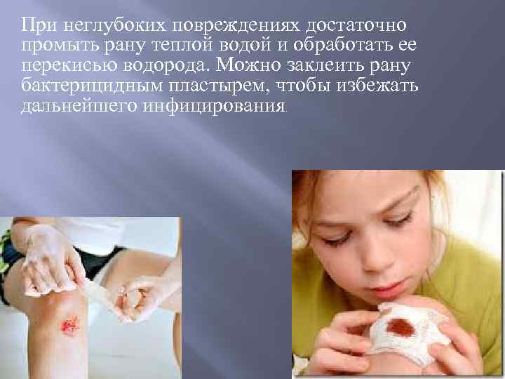 При неглубоких повреждениях достаточно промыть рану теплой водой и обработать ее перекисью водорода. Можно