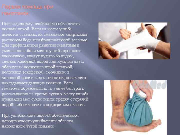 Первая помощь при гематомах. Пострадавшему необходимо обеспечить полный покой. Если на месте ушиба имеются