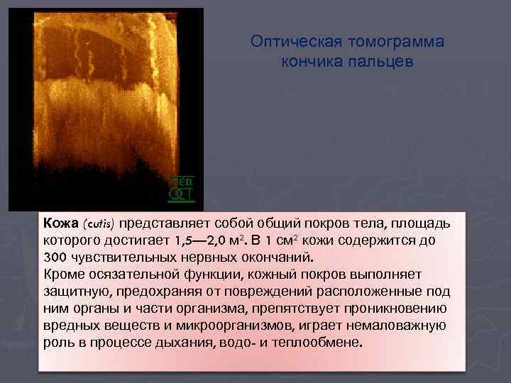 Оптическая томограмма кончика пальцев Кожа (cutis) представляет собой общий покров тела, площадь которого достигает