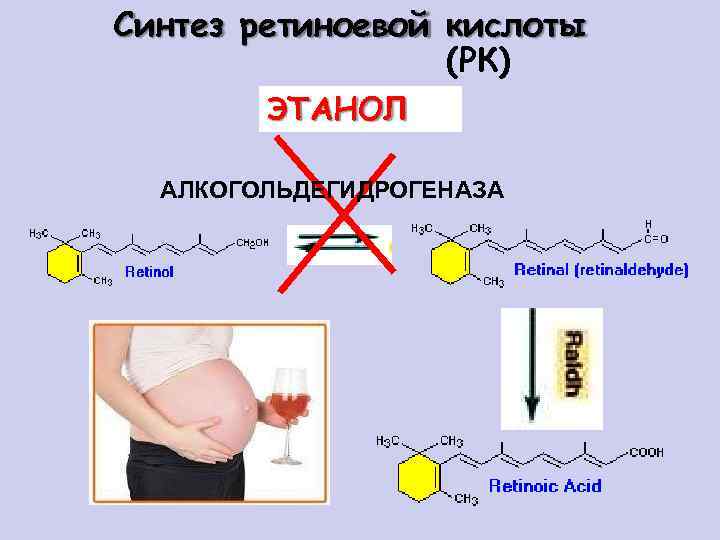 Синтез ретиноевой кислоты (РК) ЭТАНОЛ АЛКОГОЛЬДЕГИДРОГЕНАЗА 