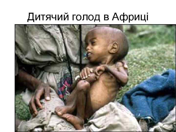 Дитячий голод в Африці 