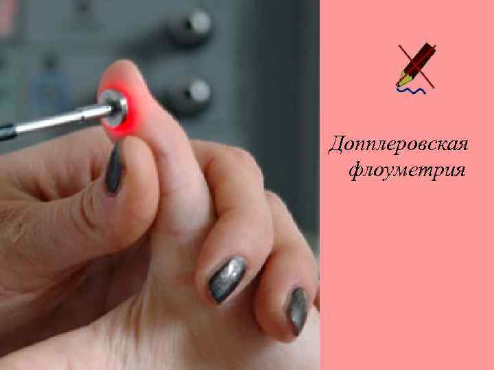 Допплеровская флоуметрия 