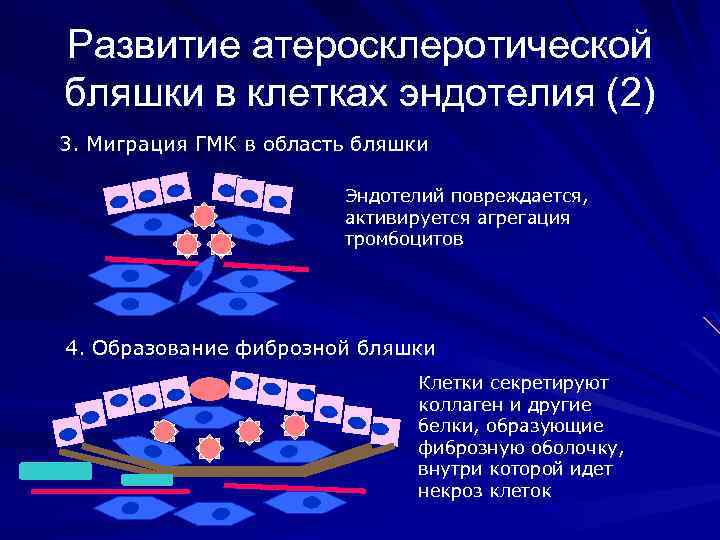 Развитие атеросклеротической бляшки в клетках эндотелия (2) 3. Миграция ГМК в область бляшки Эндотелий