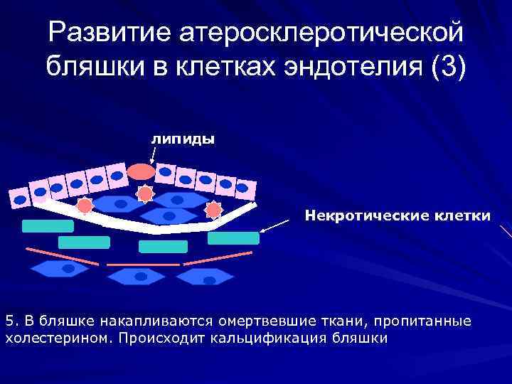 Развитие атеросклеротической бляшки в клетках эндотелия (3) липиды Некротические клетки 5. В бляшке накапливаются