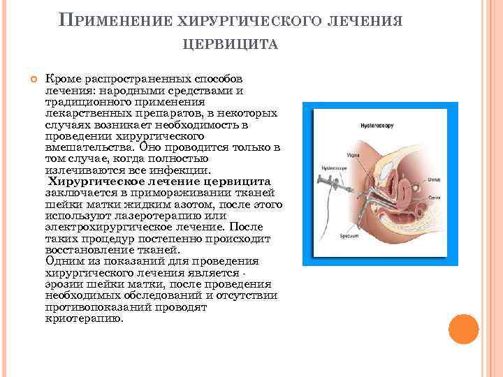 ПРИМЕНЕНИЕ ХИРУРГИЧЕСКОГО ЛЕЧЕНИЯ ЦЕРВИЦИТА Кроме распространенных способов лечения: народными средствами и традиционного применения лекарственных