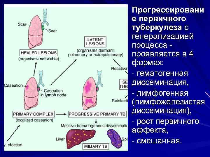 Прогрессировани е первичного туберкулеза с генерализацией процесса проявляется в 4 формах: - гематогенная диссеминация,