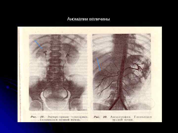 Аномалии величины 
