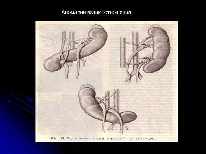 Аномалии взаимоотношения 