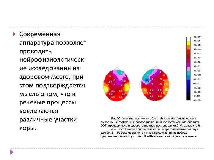  Современная аппаратура позволяет проводить нейрофизиологическ ие исследования на здоровом мозге, при этом подтверждается