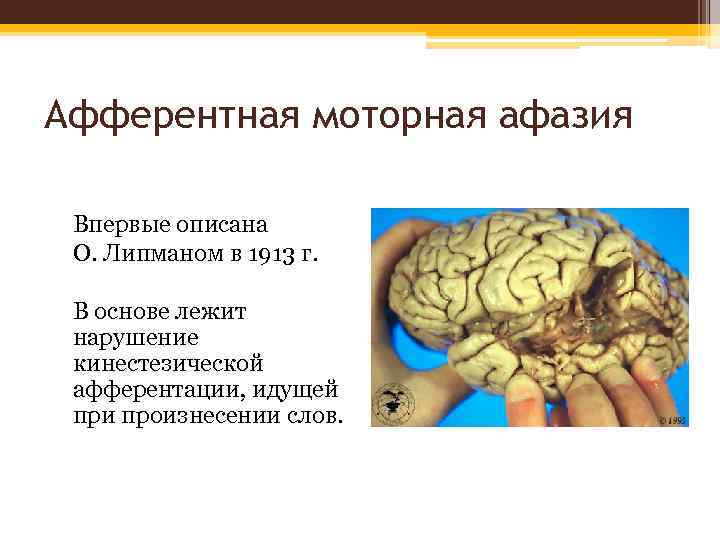 Афферентная моторная афазия Впервые описана О. Липманом в 1913 г. В основе лежит нарушение