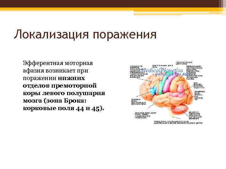 Локализация поражения Эфферентная моторная афазия возникает при поражении нижних отделов премоторной коры левого полушария