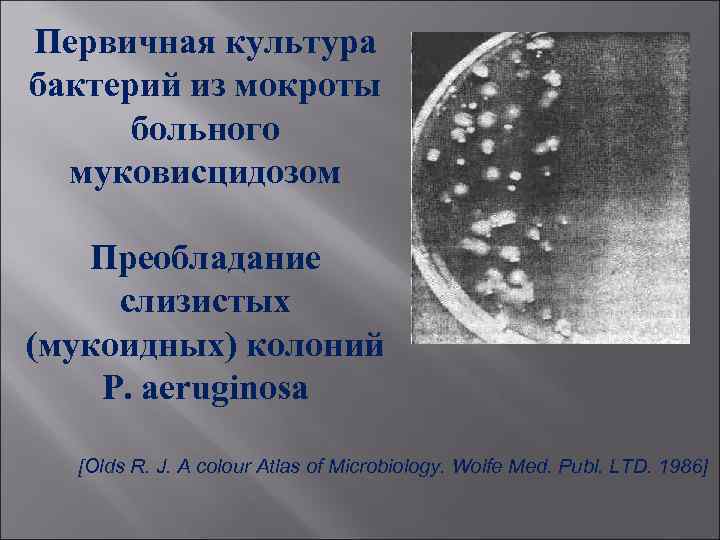 Первичная культура бактерий из мокроты больного муковисцидозом Преобладание слизистых (мукоидных) колоний Р. aeruginosa [Olds