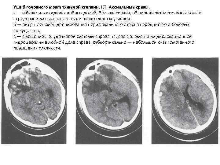 Ушиб головы карта вызова