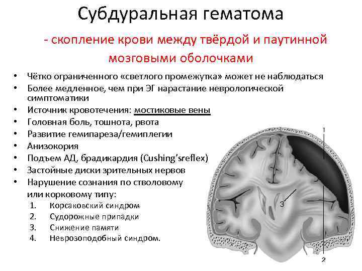 Светлый промежуток при черепно мозговой травме