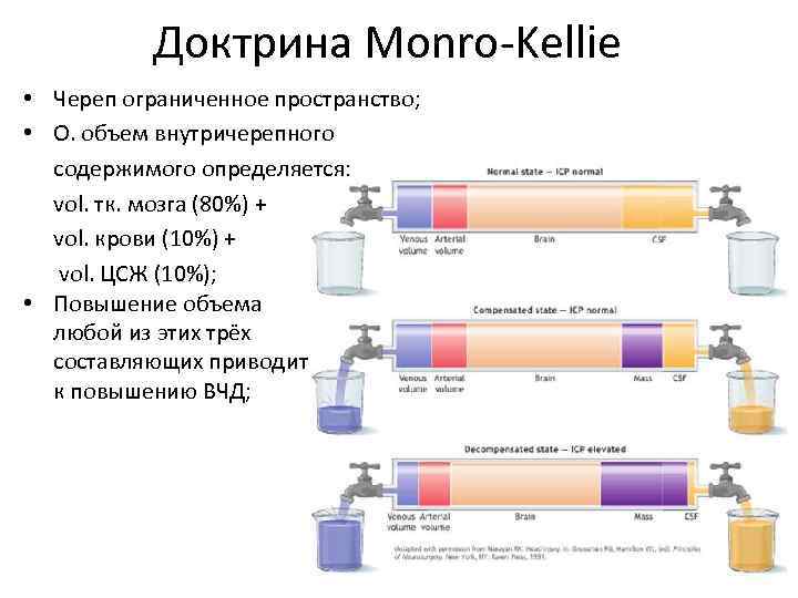 Доктрина Monro-Kellie • Череп ограниченное пространство; • О. объем внутричерепного содержимого определяется: vol. тк.