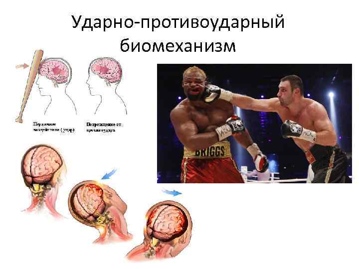 Ударно-противоударный биомеханизм 