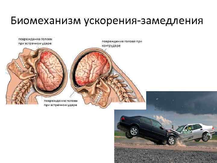 Биомеханизм ускорения-замедления Аааааааа 