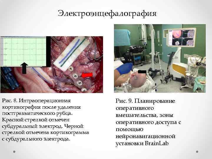 Клиническая электроэнцефалография с элементами эпилептологии руководство для врачей