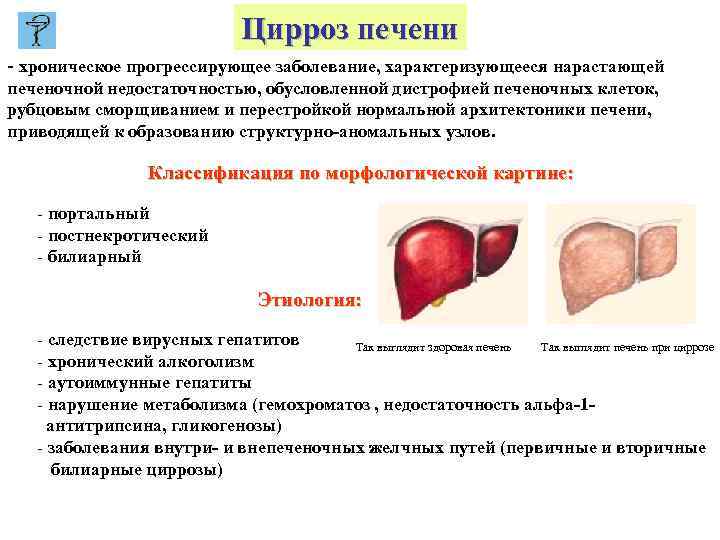 Цирроз печени - хроническое прогрессирующее заболевание, характеризующееся нарастающей печеночной недостаточностью, обусловленной дистрофией печеночных клеток,