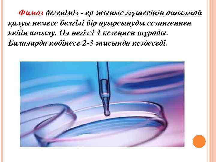 Фимоз дегеніміз - ер жыныс мүшесінің ашылмай қалуы немесе белгілі бір ауырсынуды сезингеннен кейін