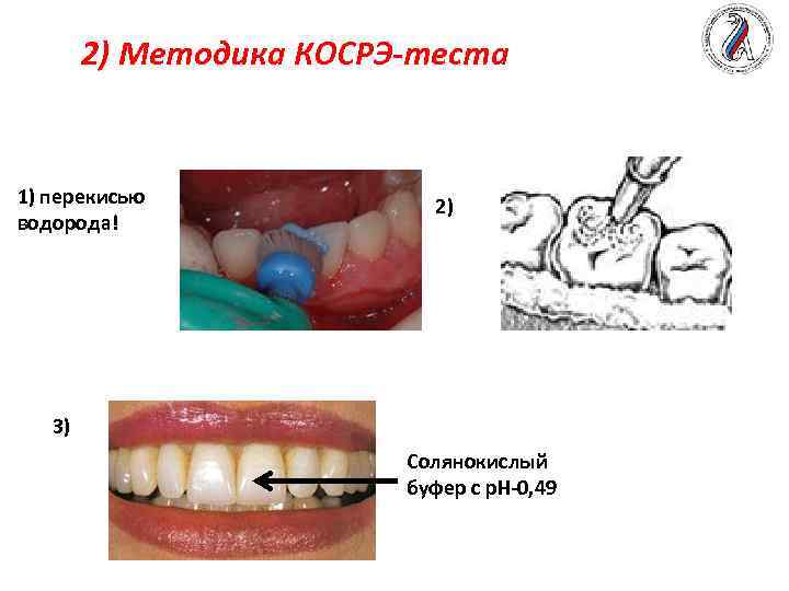 2) Методика КОСРЭ-теста 1) перекисью водорода! 2) 3) Солянокислый буфер с р. Н-0, 49