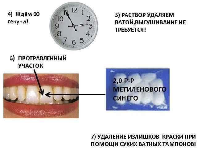 4) Ждём 60 секунд! 5) РАСТВОР УДАЛЯЕМ ВАТОЙ, ВЫСУШИВАНИЕ НЕ ТРЕБУЕТСЯ! 6) ПРОТРАВЛЕННЫЙ УЧАСТОК