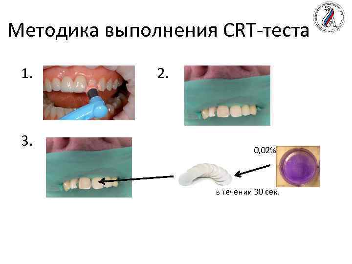 Методика выполнения CRT-теста 1. 3. 2. 0, 02% в течении 30 сек. 