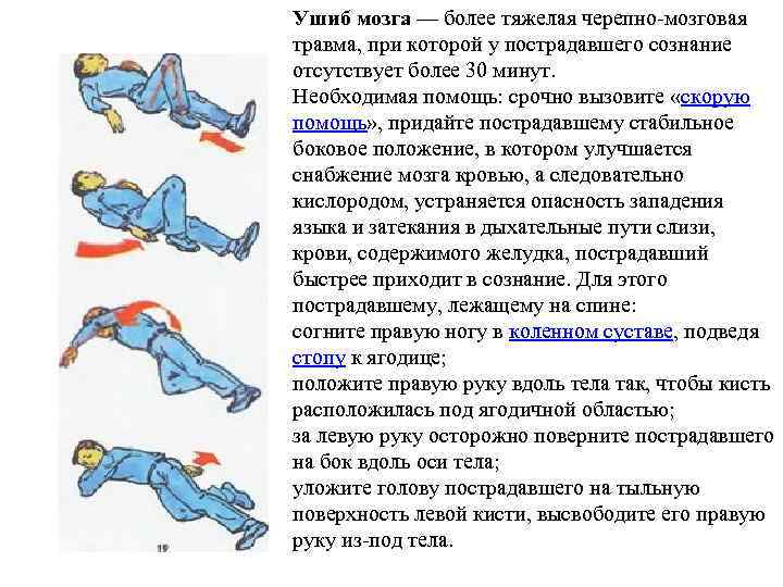 Ушиб мозга — более тяжелая черепно-мозговая травма, при которой у пострадавшего сознание отсутствует более