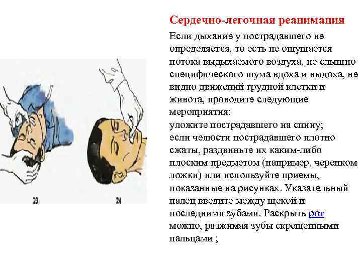 Сердечно-легочная реанимация Если дыхание у пострадавшего не определяется, то есть не ощущается потока выдыхаемого