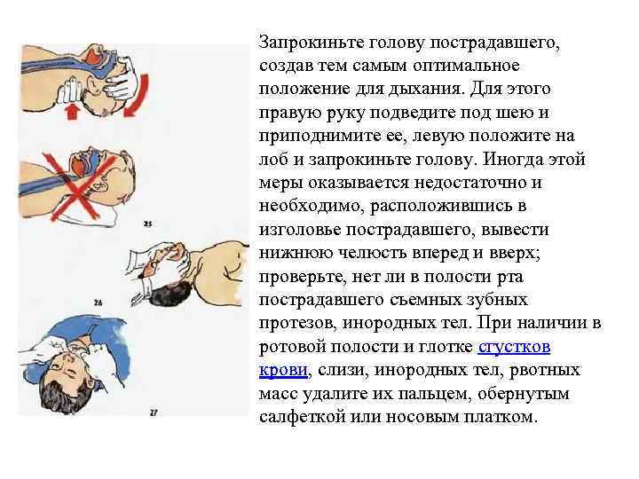 Запрокиньте голову пострадавшего, создав тем самым оптимальное положение для дыхания. Для этого правую руку